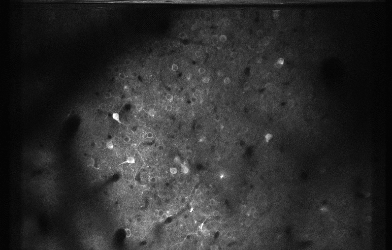 spatial compensation